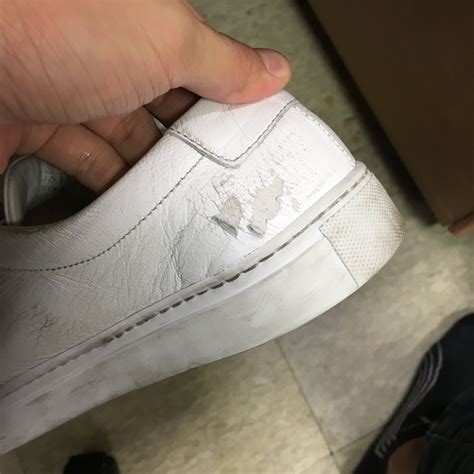 leather shoes peeling inside